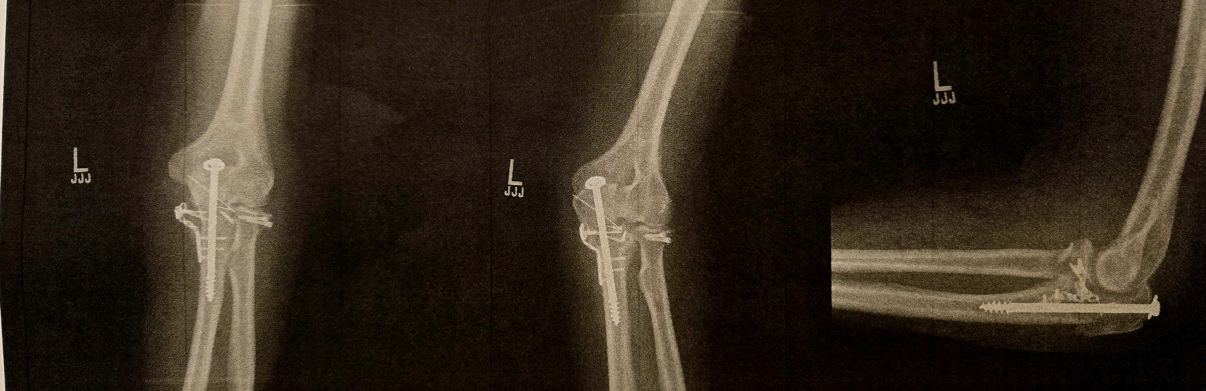 Hospital