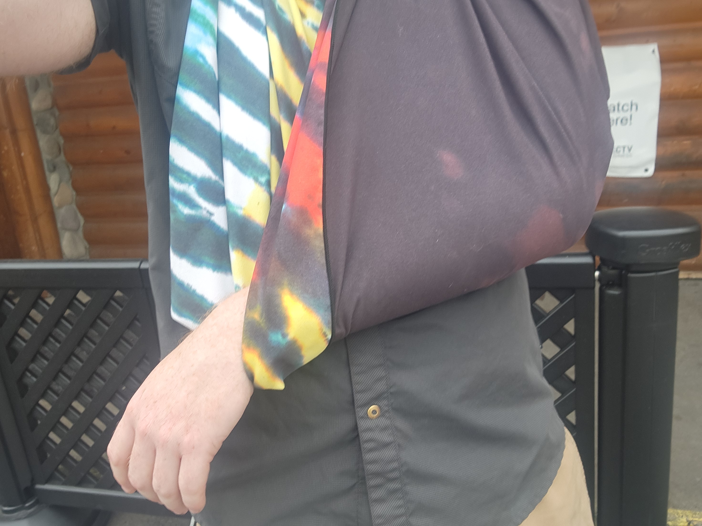 Arm in sling